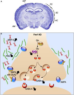 Fragile X Syndrome as an interneuronopathy: a lesson for future studies and treatments